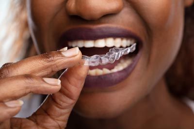 woman putting in her new SureSmile clear aligners